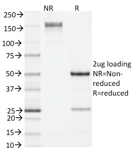 Interleukin 4 / IL-4 , Mouse Monoclonal Rat Antibody (11B11)