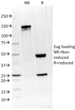 Interleukin 4 / IL4 Monoclonal Mouse Antibody (IL4/1597)
