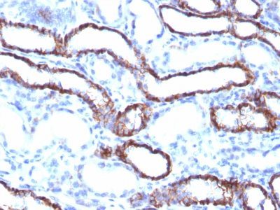 Ksp-Cadherin / CDH16 Monoclonal Mouse Antibody (CDH16/1071)