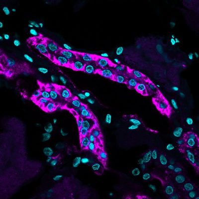 Ksp-Cadherin / CDH16 Monoclonal Mouse Antibody (CDH16/1071)
