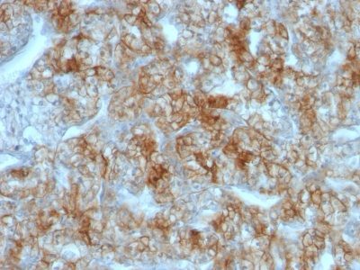 Ksp-Cadherin / CDH16 Monoclonal Mouse Antibody (CDH16/1071)
