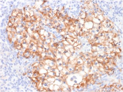 Ksp-Cadherin / CDH16 Monoclonal Mouse Antibody (CDH16/2125)