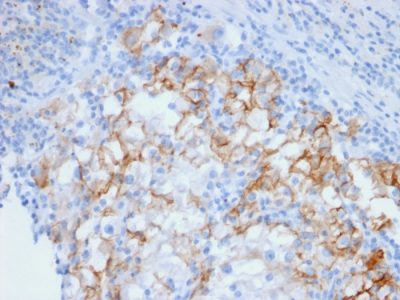Ksp-Cadherin / CDH16 Monoclonal Mouse Antibody (CDH16/2448)