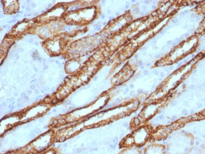 Ksp-Cadherin / CDH16 Polyclonal Rabbit Antibody