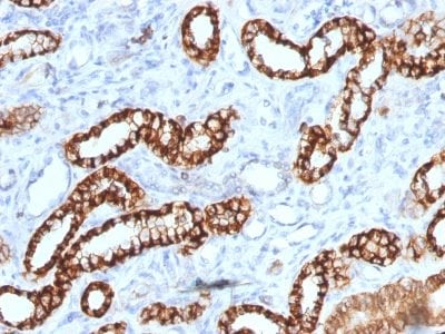 Ksp-Cadherin / CDH16 Recombinant Monoclonal Mouse Antibody (rCDH16/1071)