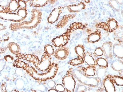 Ksp-Cadherin / CDH16 Recombinant Monoclonal Rabbit Antibody (CDH16/1532R)