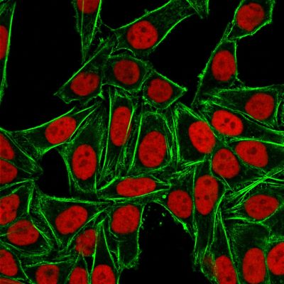 Ku-Holo Monoclonal Mouse Antibody (KU729)