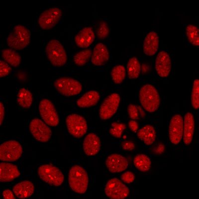 Ku-Holo Monoclonal Mouse Antibody (KU729)