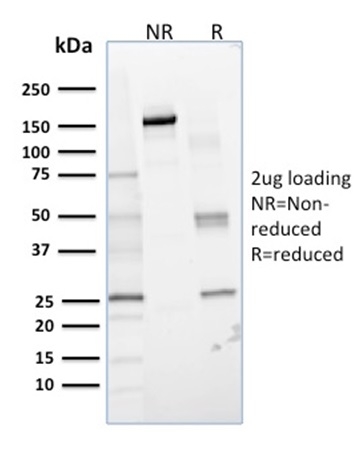Lactoylglutathione Lyase Monoclonal Mouse Antibody (CPTC-GLO1-1)