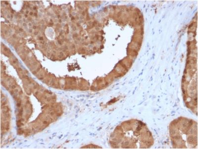 Lactoylglutathione Lyase Monoclonal Mouse Antibody (CPTC-GLO1-3)