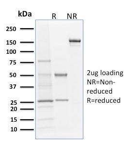 Langerin / CD207 Monoclonal Mouse Antibody (LGRN/1821)