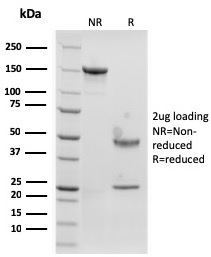 Langerin / CD207 Recombinant Monoclonal Mouse Antibody (rLGRN/1821)