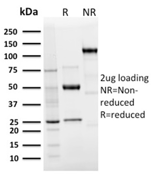 Langerin / CD207 Recombinant Monoclonal Rabbit Antibody (LGRN/3136R)