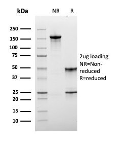 Lymphocyte Activation Gene 3 Monoclonal Mouse Antibody (LAG3/3261)