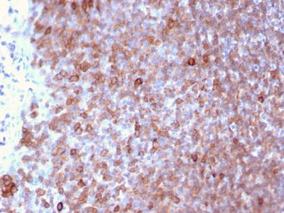 Lymphocyte Specific Protein 1 / pp52 Monoclonal Mouse Antibody (LSP1/3025)