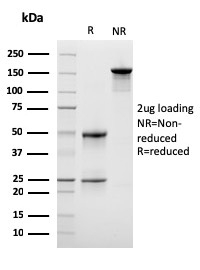 Lymphocyte Specific Protein 1 / pp52 Monoclonal Mouse Antibody (LSP1/3042)