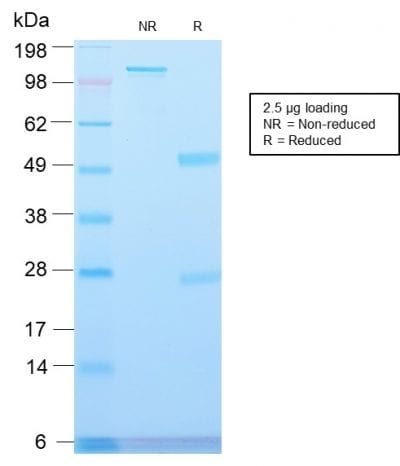 Major Vault Protein Recombinant Monoclonal Rabbit Antibody (VP2897R)