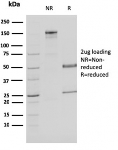 Malate dehydrogenase 1 NAD Monoclonal Mouse Antibody (CPTC-MDH1-1)