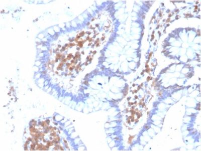 MAPK14 Monoclonal Mouse Antibody (CPTC-MAPK14-1)