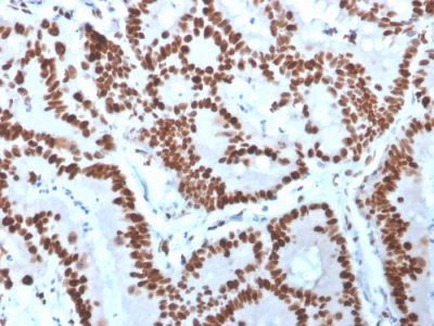 MCM6 Monoclonal Mouse Antibody (MCM6/3000)
