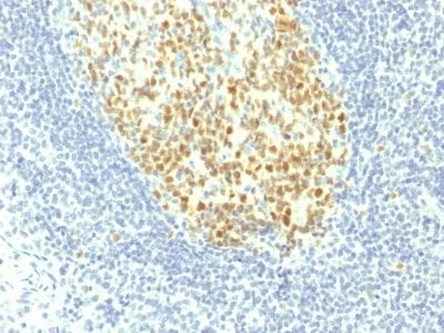 MCM7 Monoclonal Mouse Antibody (MCM7/1467)