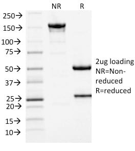 MCM7 Monoclonal Mouse Antibody (MCM7/1467)