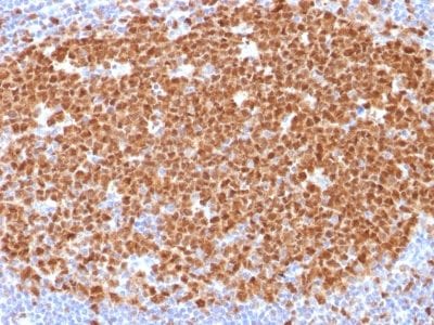 MCM7 Monoclonal Mouse Antibody (MCM7/1468)