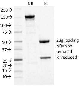 MCM7 Monoclonal Mouse Antibody (MCM7/1468)