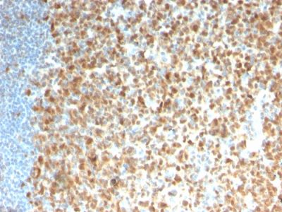 MCM7 Recombinant Monoclonal Mouse Antibody (rMCM7/1468)