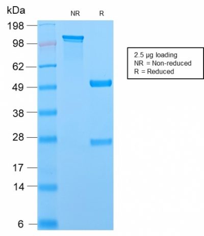 MCM7 Recombinant Monoclonal Rabbit Antibody (MCM7/2756R)