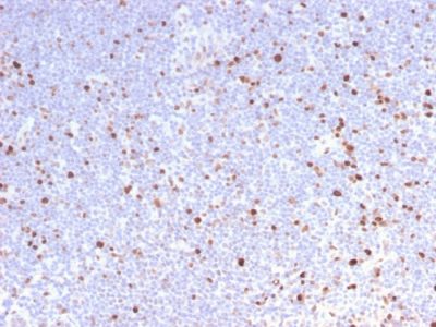 MCM7 Recombinant Monoclonal Rabbit Antibody (MCM7/2832R)