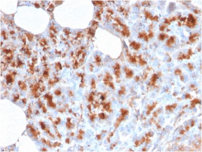 MDM2 Monoclonal Mouse Antibody (MDM2/2414)