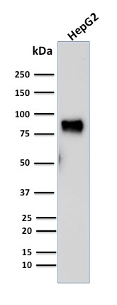 MDM2 Monoclonal Mouse Antibody (SMP14)