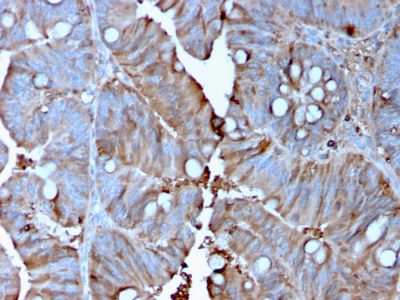 MerTK Monoclonal Mouse Antibody (MERTK/3015)