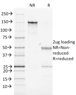 MHC II, Mouse Monoclonal Mouse Antibody (MK-D6)