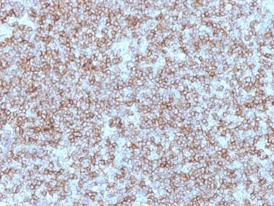 MHC-II Monoclonal Mouse Antibody (Bra-14)