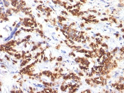 Milk Fat Globulin Monoclonal Mouse Antibody (MFG 06)