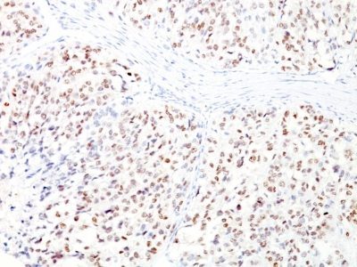 MiTF Monoclonal Mouse Antibody (D5 + MITF/915)