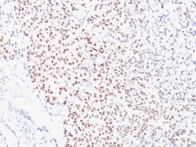 MiTF Monoclonal Mouse Antibody (D5)