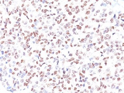 MiTF Monoclonal Mouse Antibody (MITF/915)