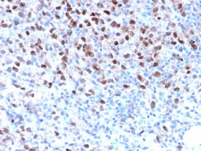 MiTF Recombinant Monoclonal Rabbit Antibody (MITF/2987R)