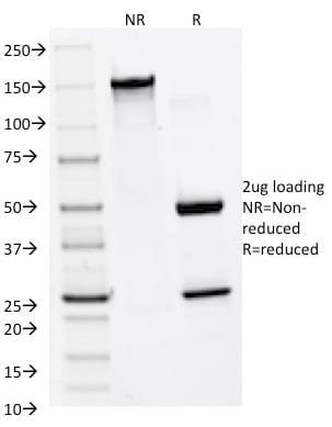MMP2 / Collagenase-Type-IV-A Monoclonal Mouse Antibody (MMP2/1501)