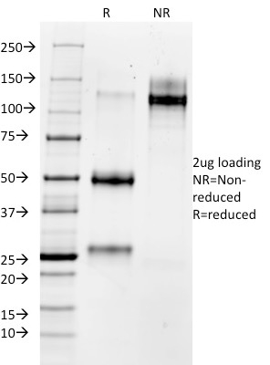 MMP3 Monoclonal Mouse Antibody (MMP3/1730)