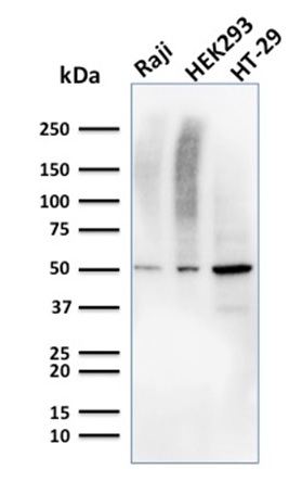 MMP3 Monoclonal Mouse Antibody (MMP3/2655)