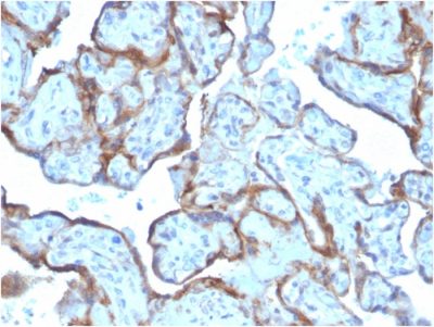MMP3 Monoclonal Mouse Antibody (MMP3/2806)