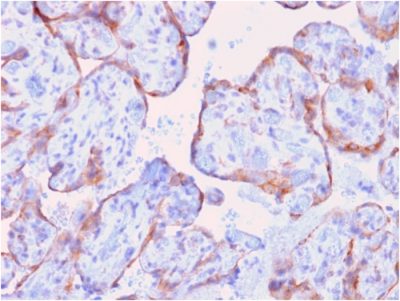 MMP3 Recombinant Monoclonal Mouse Antibody (rMMP3/1730)