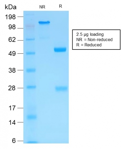 MMP3 Recombinant Monoclonal Rabbit Antibody (MMP3/1994R)