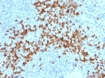 MMP9 Monoclonal Mouse Antibody (2C3)