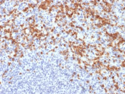 MMP9 Monoclonal Mouse Antibody (MMP9/2477)