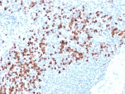 MMP9 Recombinant Monoclonal Mouse Antibody (rMMP9/1769)